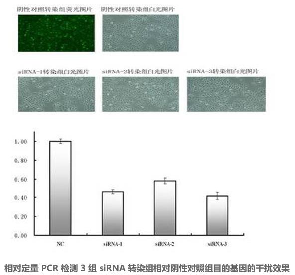 圖片21-siRNA的細(xì)胞轉(zhuǎn)染及篩選.jpg
